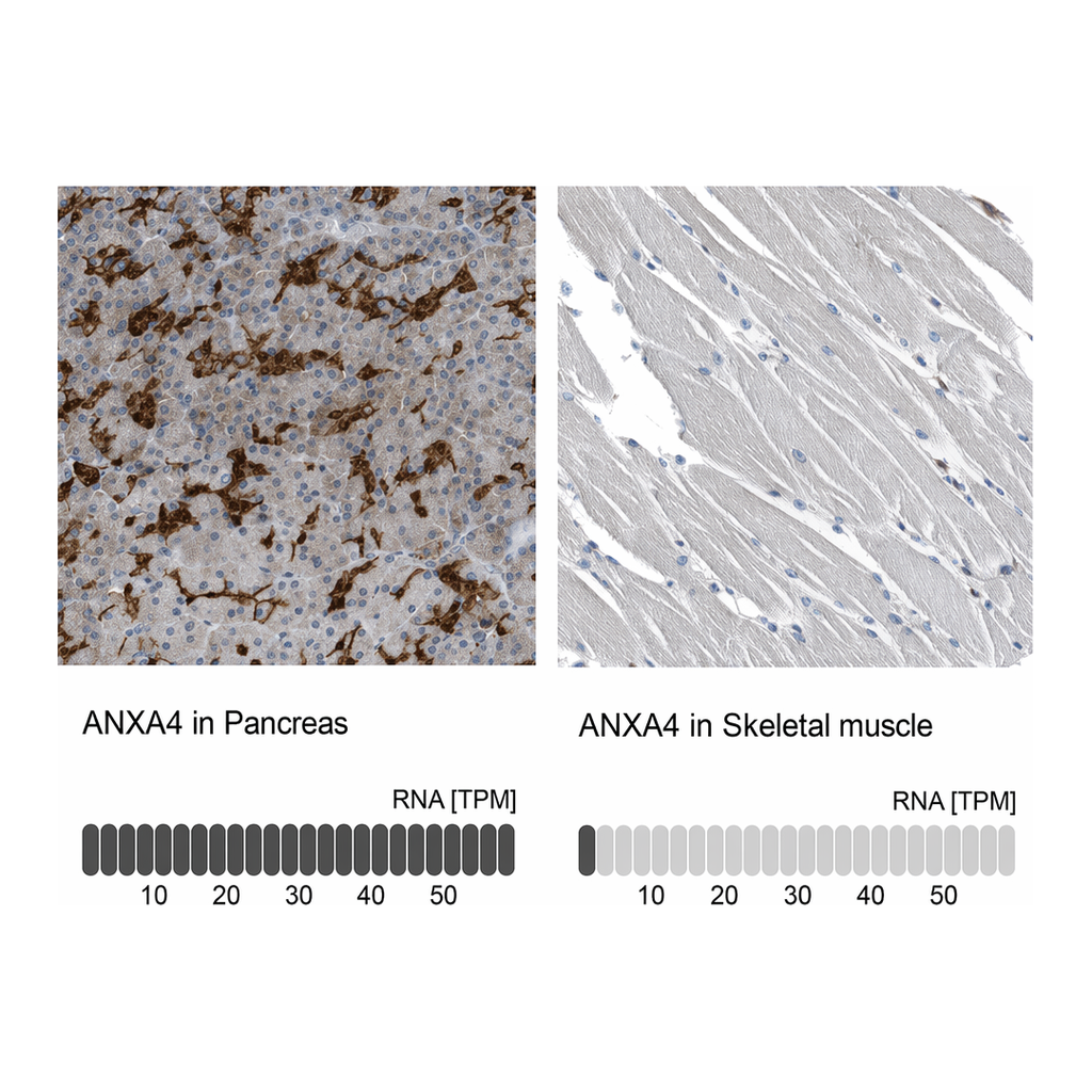 Atlas Antibodies Anti-ANXA4 Antibody