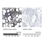 Atlas Antibodies Anti-ANXA3 Antibody