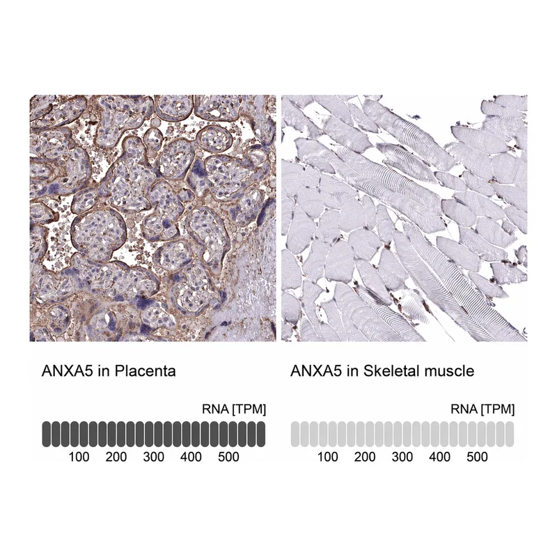 Atlas Antibodies Anti-ANXA5 Antibody
