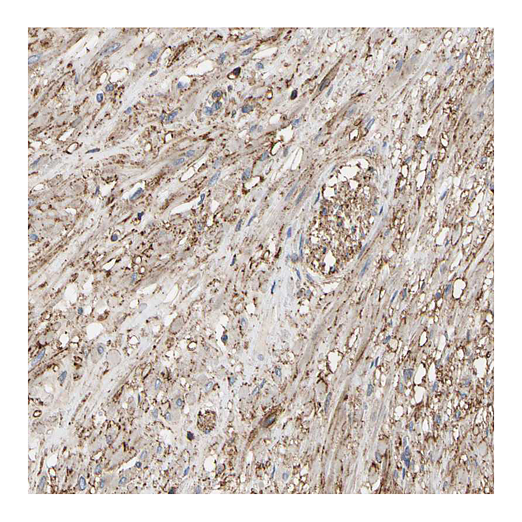 Atlas Antibodies Anti-ANXA6 Antibody