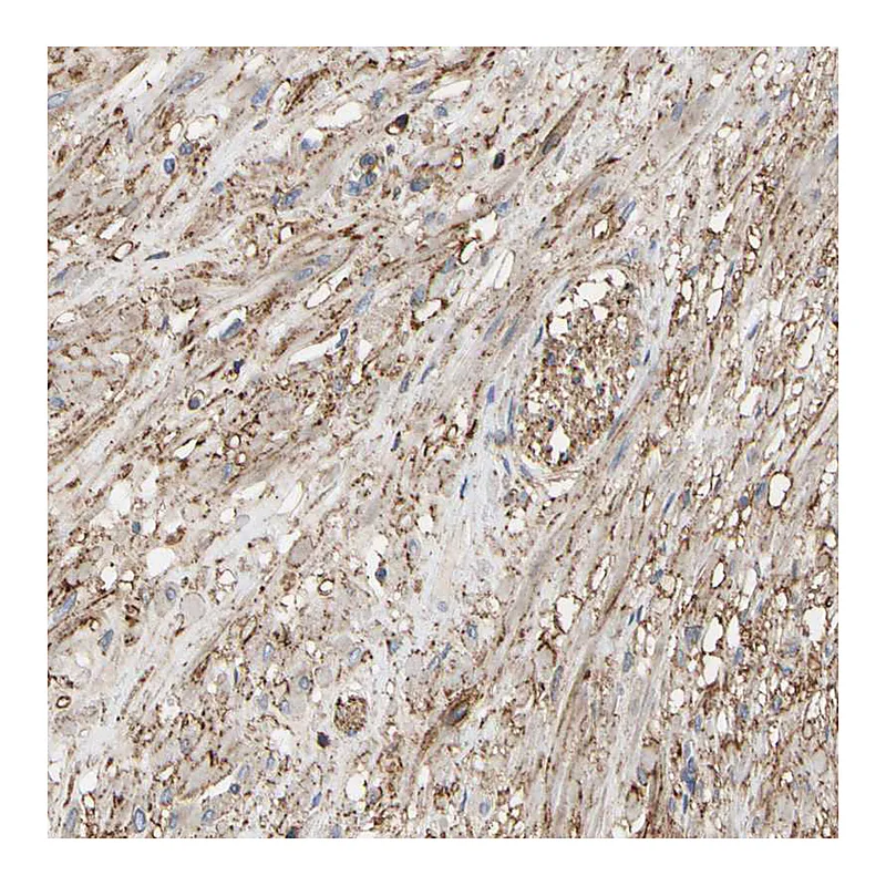 Atlas Antibodies Anti-ANXA6 Antibody