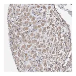 Atlas Antibodies Anti-AOC1 Antibody