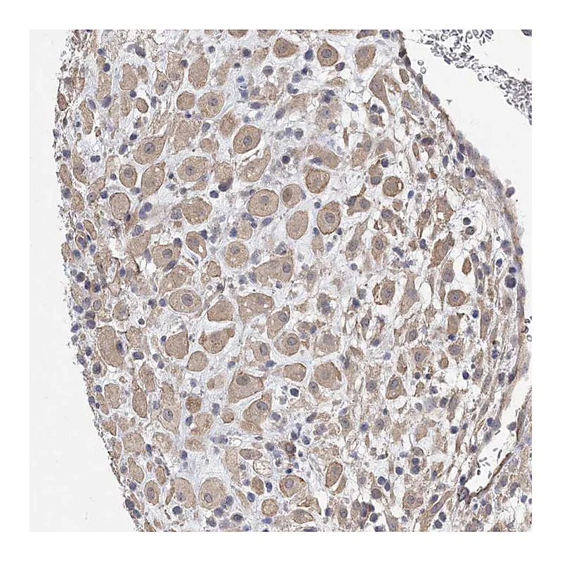 Atlas Antibodies Anti-AOC1 Antibody