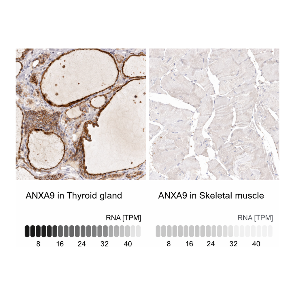 Atlas Antibodies Anti-ANXA9 Antibody