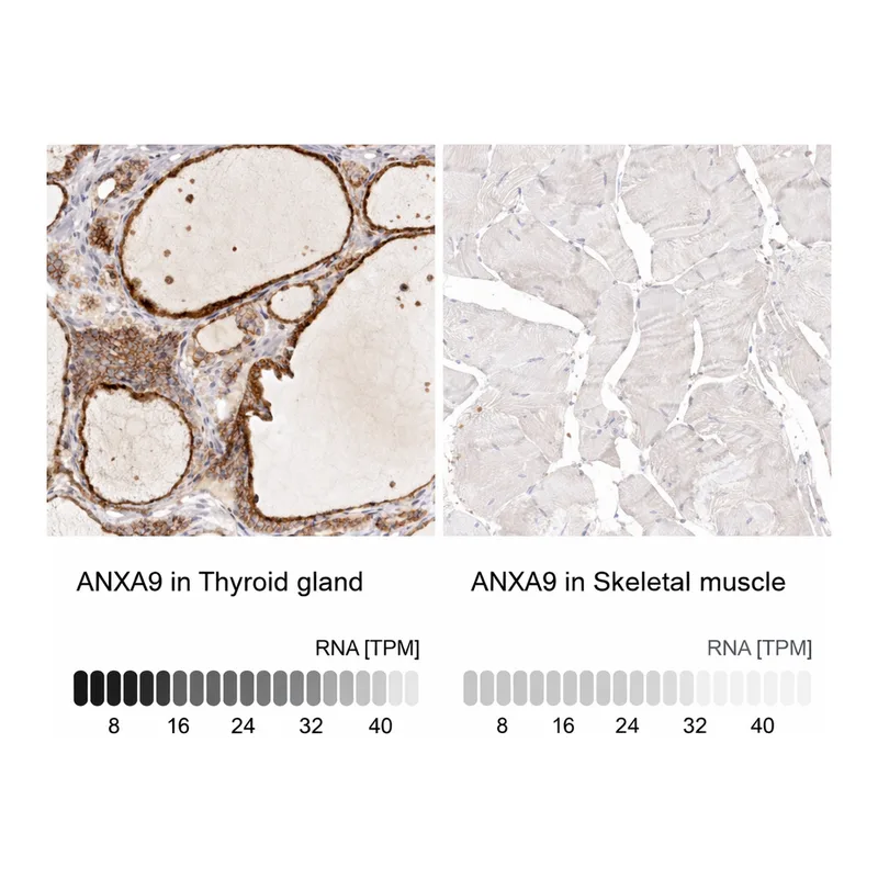 Atlas Antibodies Anti-ANXA9 Antibody