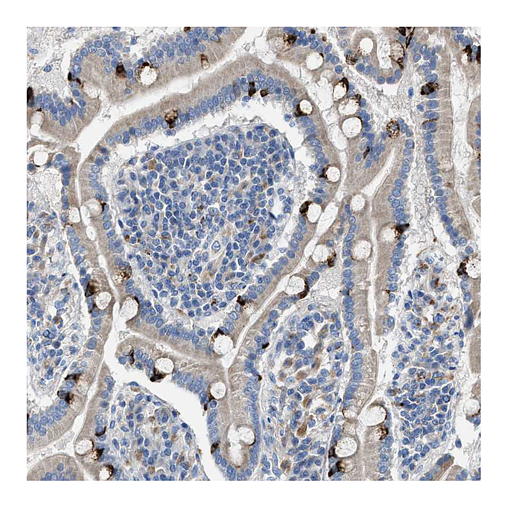 Atlas Antibodies Anti-AOAH Antibody