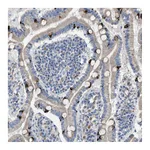 Atlas Antibodies Anti-AOAH Antibody