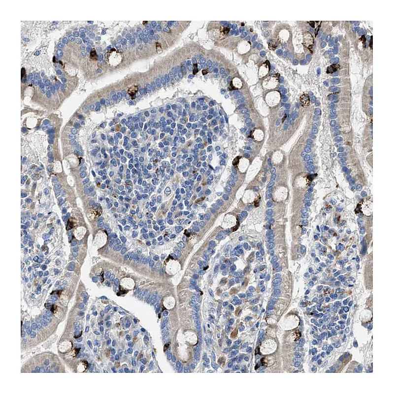Atlas Antibodies Anti-AOAH Antibody