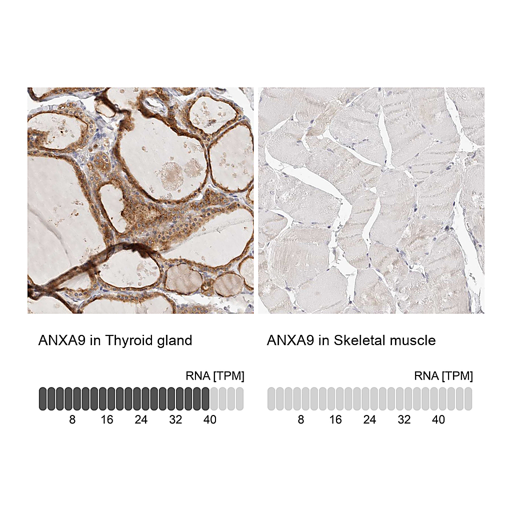 Atlas Antibodies Anti-ANXA9 Antibody