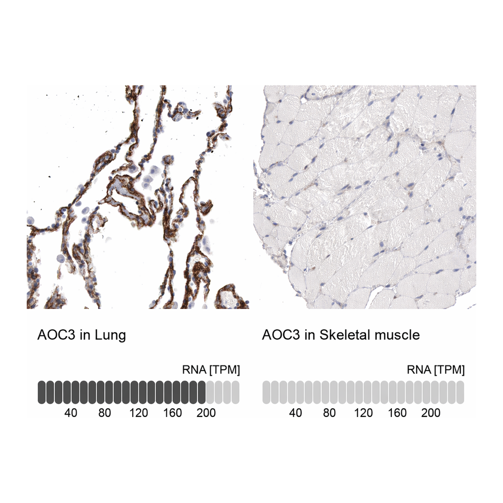 Atlas Antibodies Anti-AOC3 Antibody