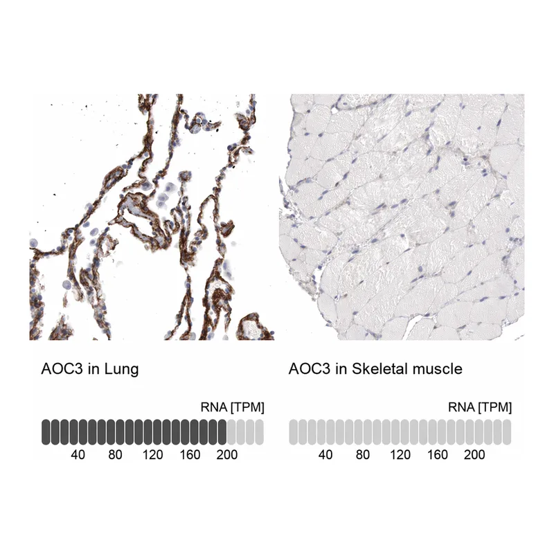 Atlas Antibodies Anti-AOC3 Antibody
