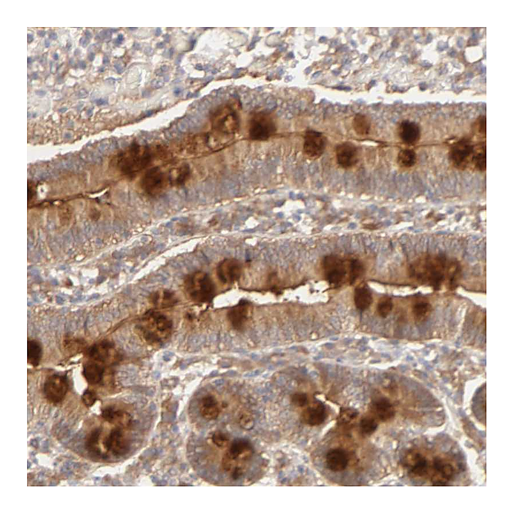 Atlas Antibodies Anti-AP1G2 Antibody