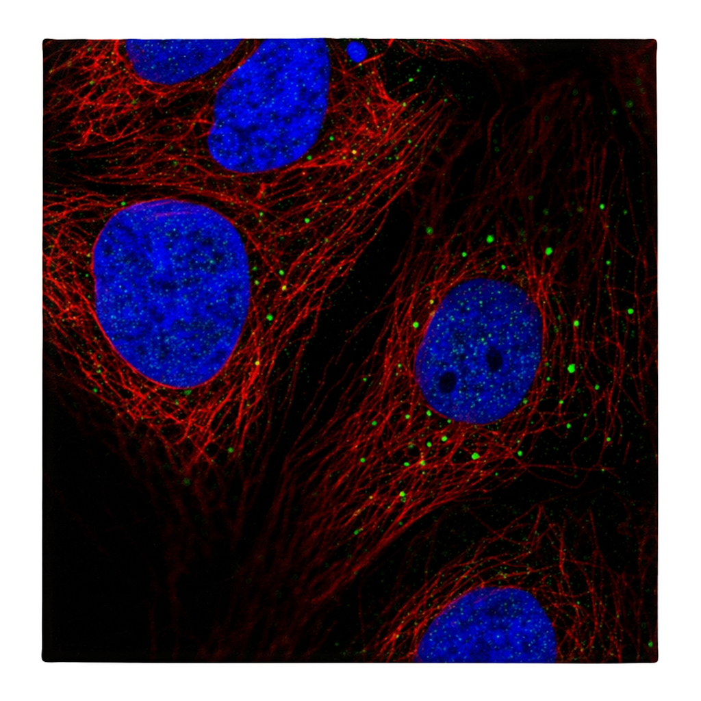 Atlas Antibodies Anti-AP1M2 Antibody