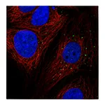 Atlas Antibodies Anti-AP1M2 Antibody