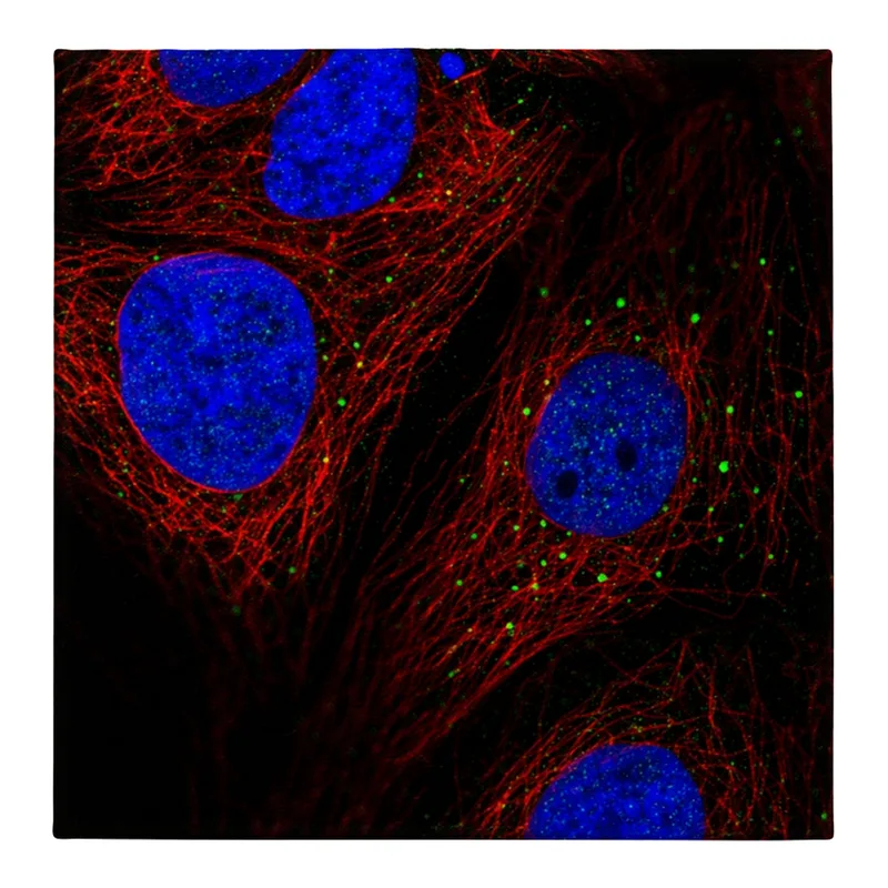 Atlas Antibodies Anti-AP1M2 Antibody