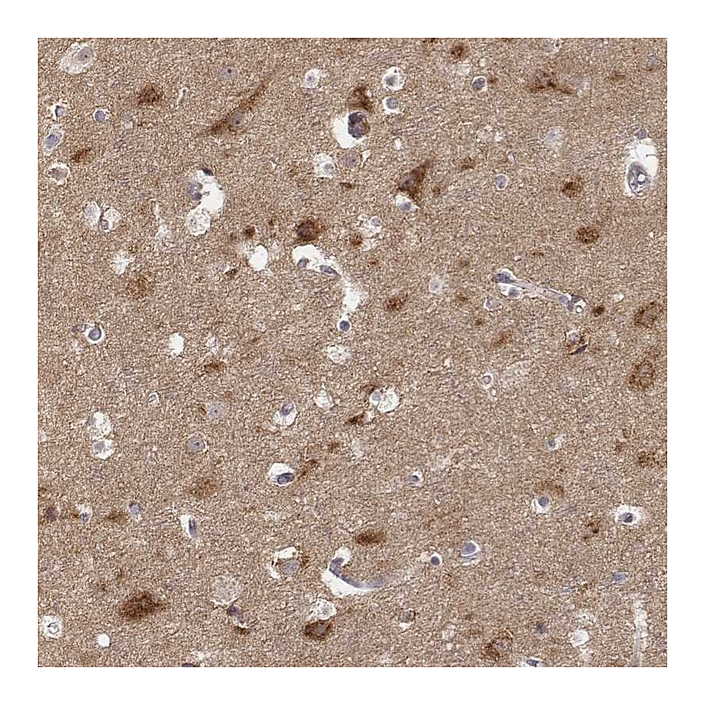 Atlas Antibodies Anti-AP1B1 Antibody