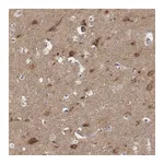 Atlas Antibodies Anti-AP1B1 Antibody