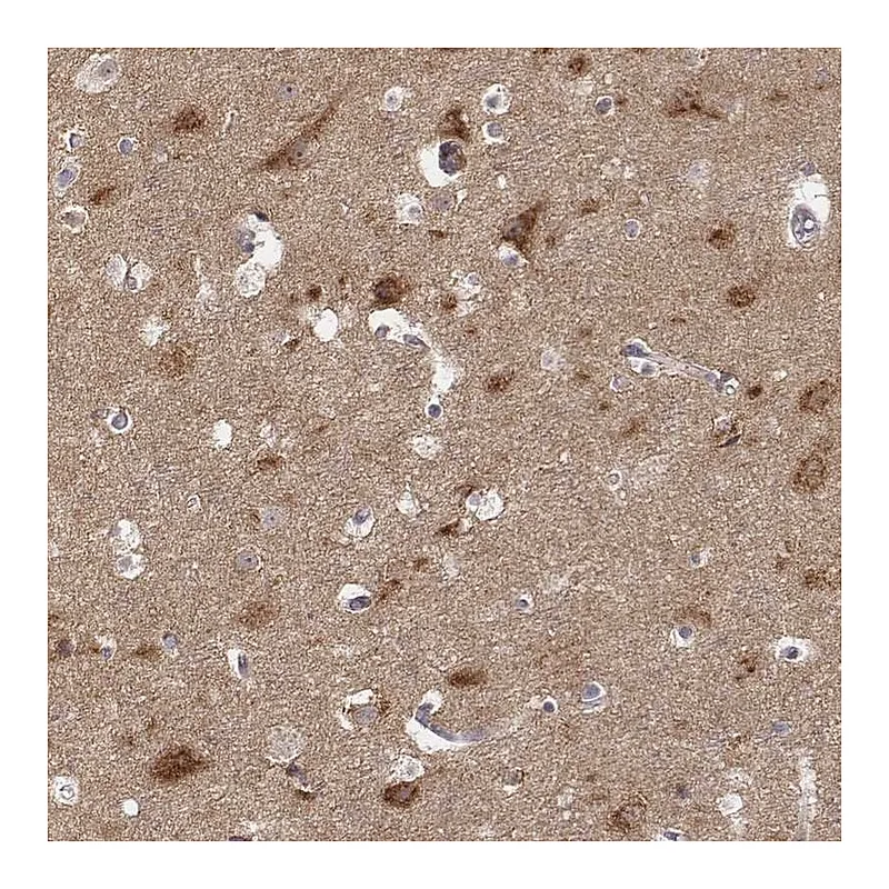 Atlas Antibodies Anti-AP1B1 Antibody