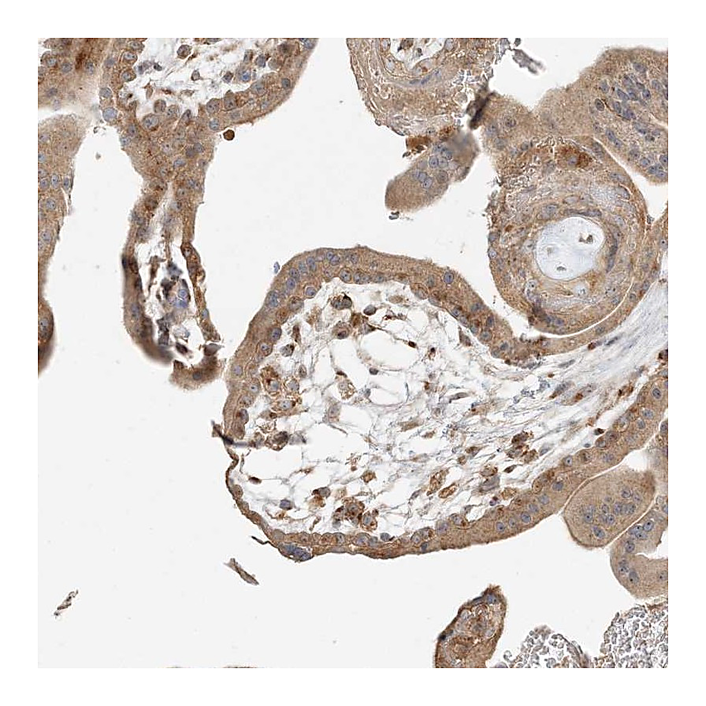 Atlas Antibodies Anti-AP1AR Antibody