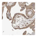 Atlas Antibodies Anti-AP1AR Antibody
