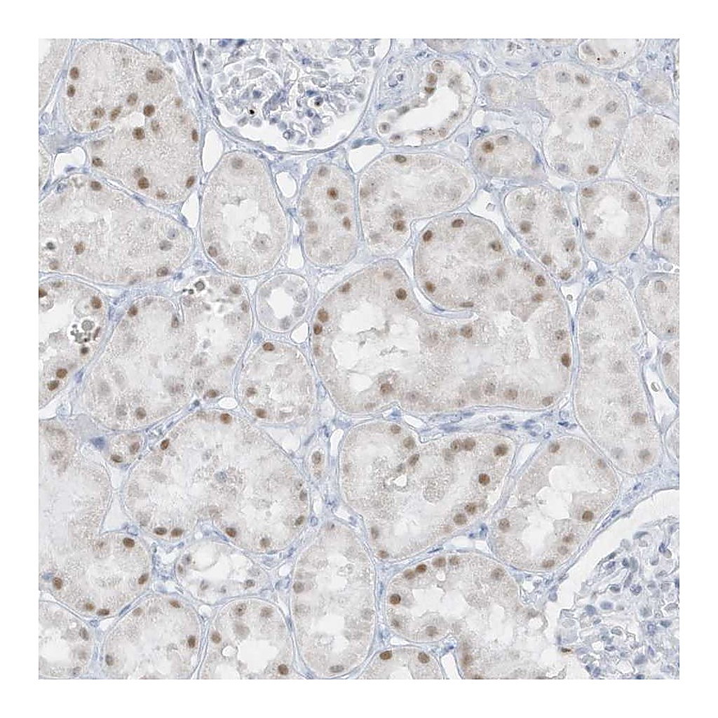 Atlas Antibodies Anti-AP000322.53 Antibody