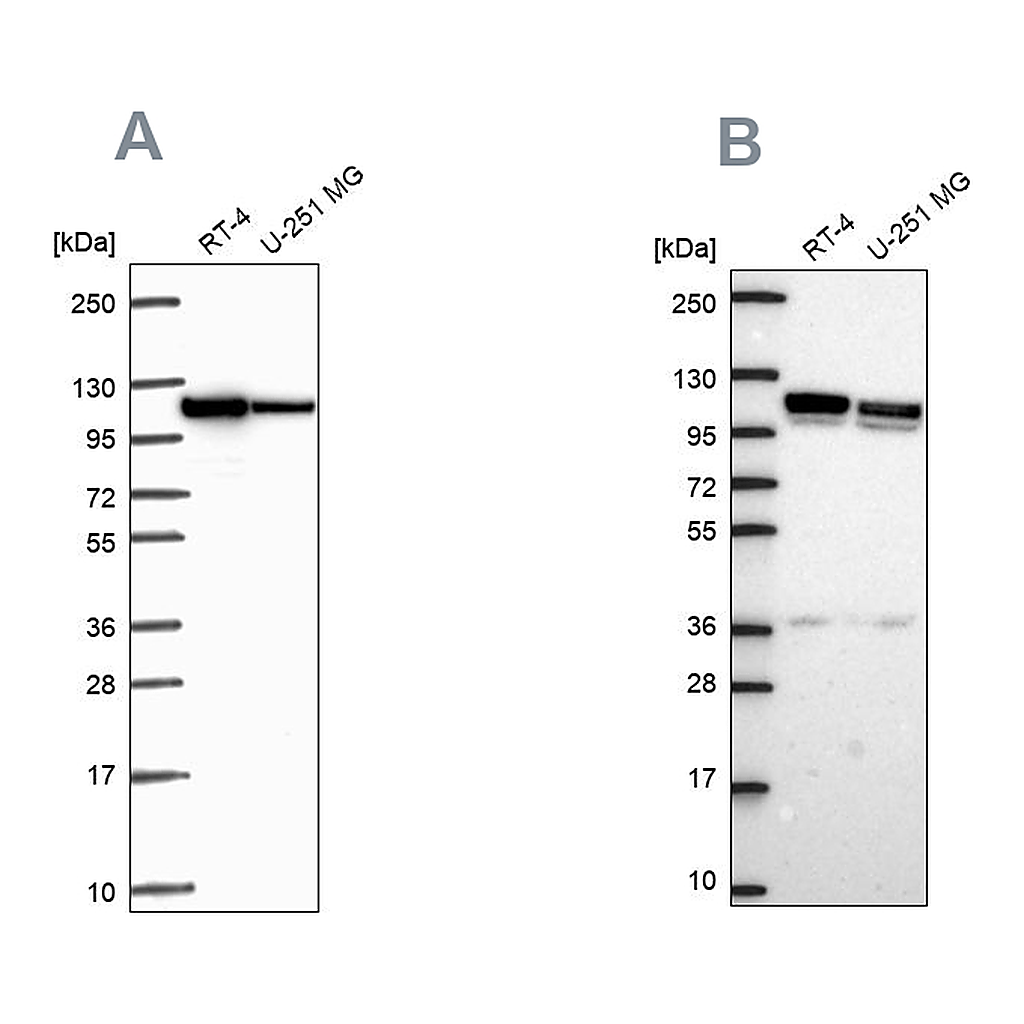 Atlas Antibodies Anti-AP1B1 Antibody