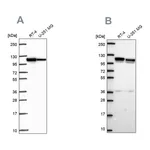 Atlas Antibodies Anti-AP1B1 Antibody