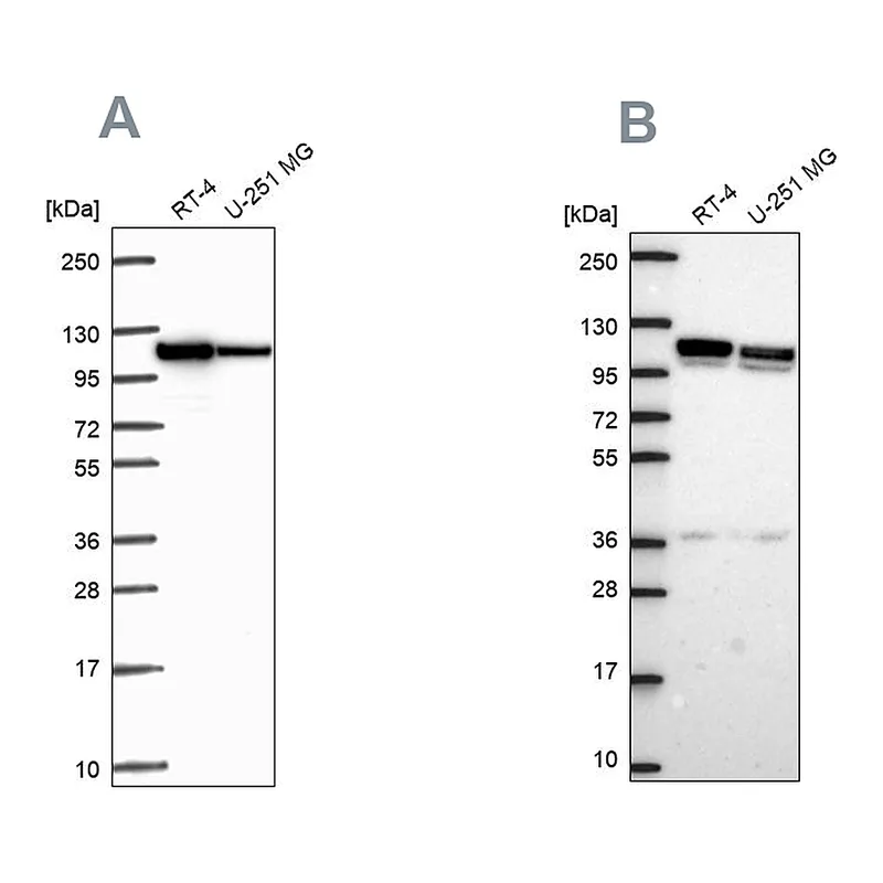 Atlas Antibodies Anti-AP1B1 Antibody
