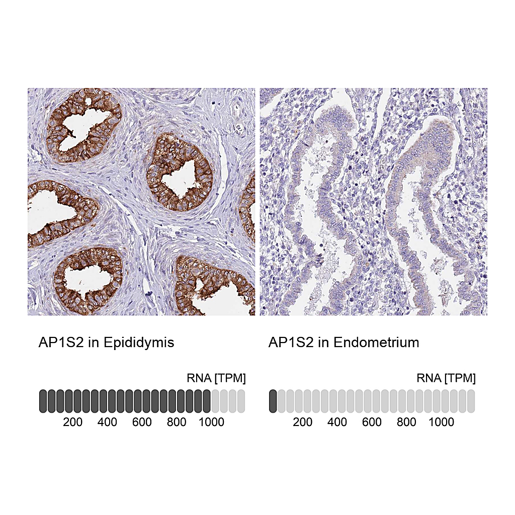 Atlas Antibodies Anti-AP1S2 Antibody