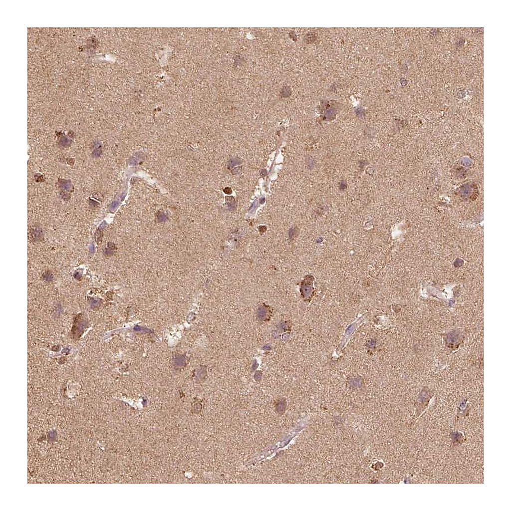 Atlas Antibodies Anti-AP2B1 Antibody