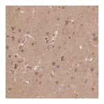 Atlas Antibodies Anti-AP2B1 Antibody