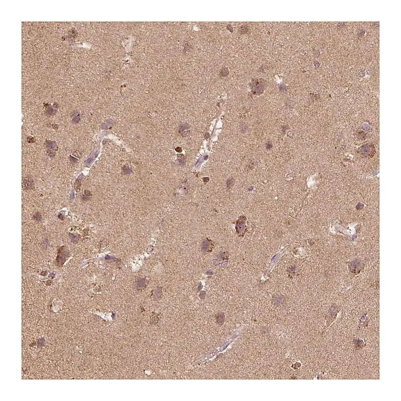 Atlas Antibodies Anti-AP2B1 Antibody