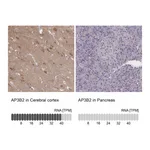 Atlas Antibodies Anti-AP3B2 Antibody