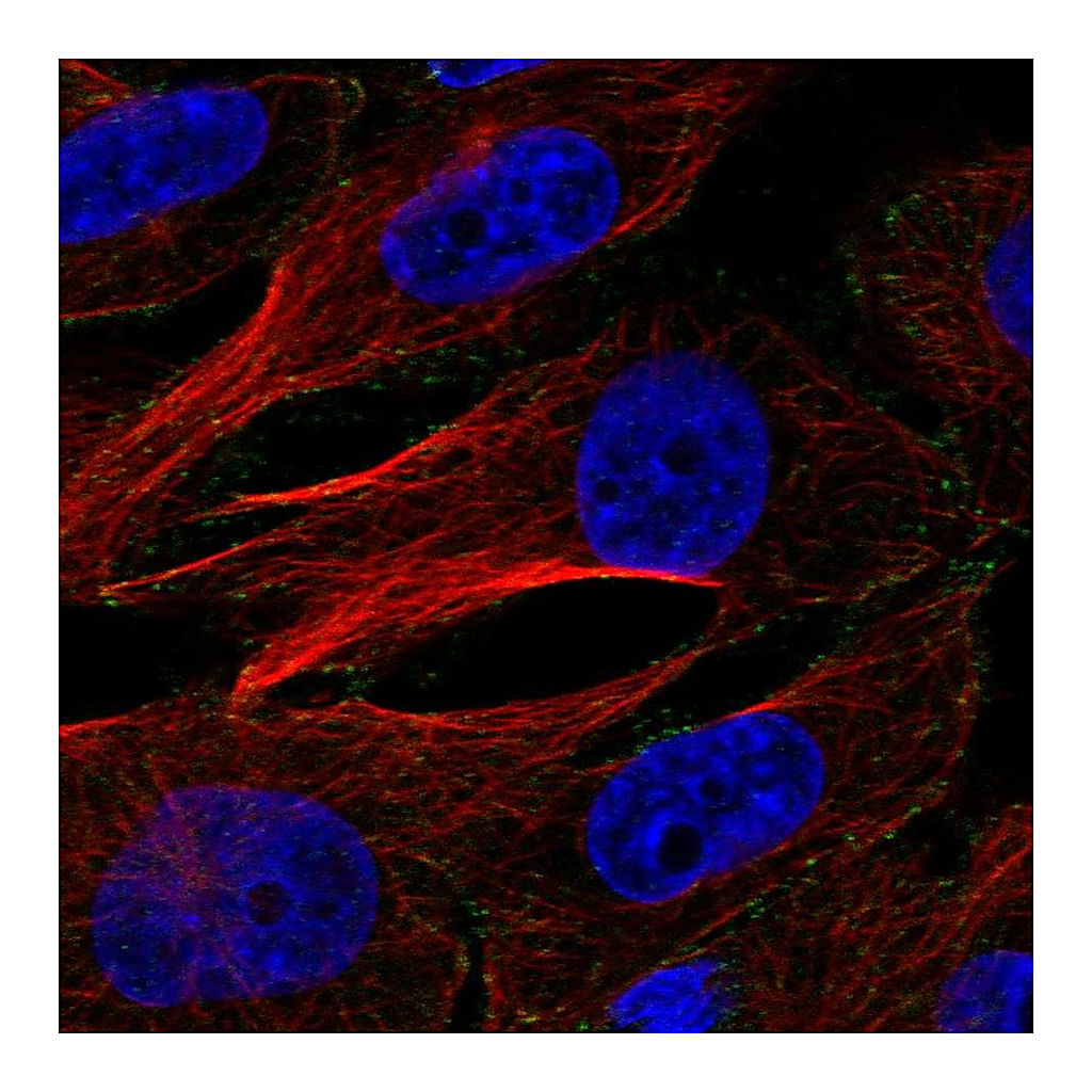 Atlas Antibodies Anti-AP2M1 Antibody