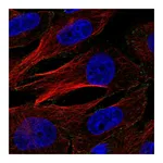 Atlas Antibodies Anti-AP2M1 Antibody