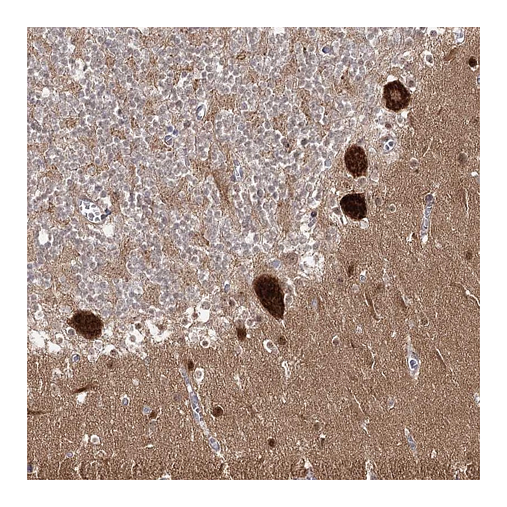 Atlas Antibodies Anti-AP2M1 Antibody