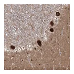 Atlas Antibodies Anti-AP2M1 Antibody