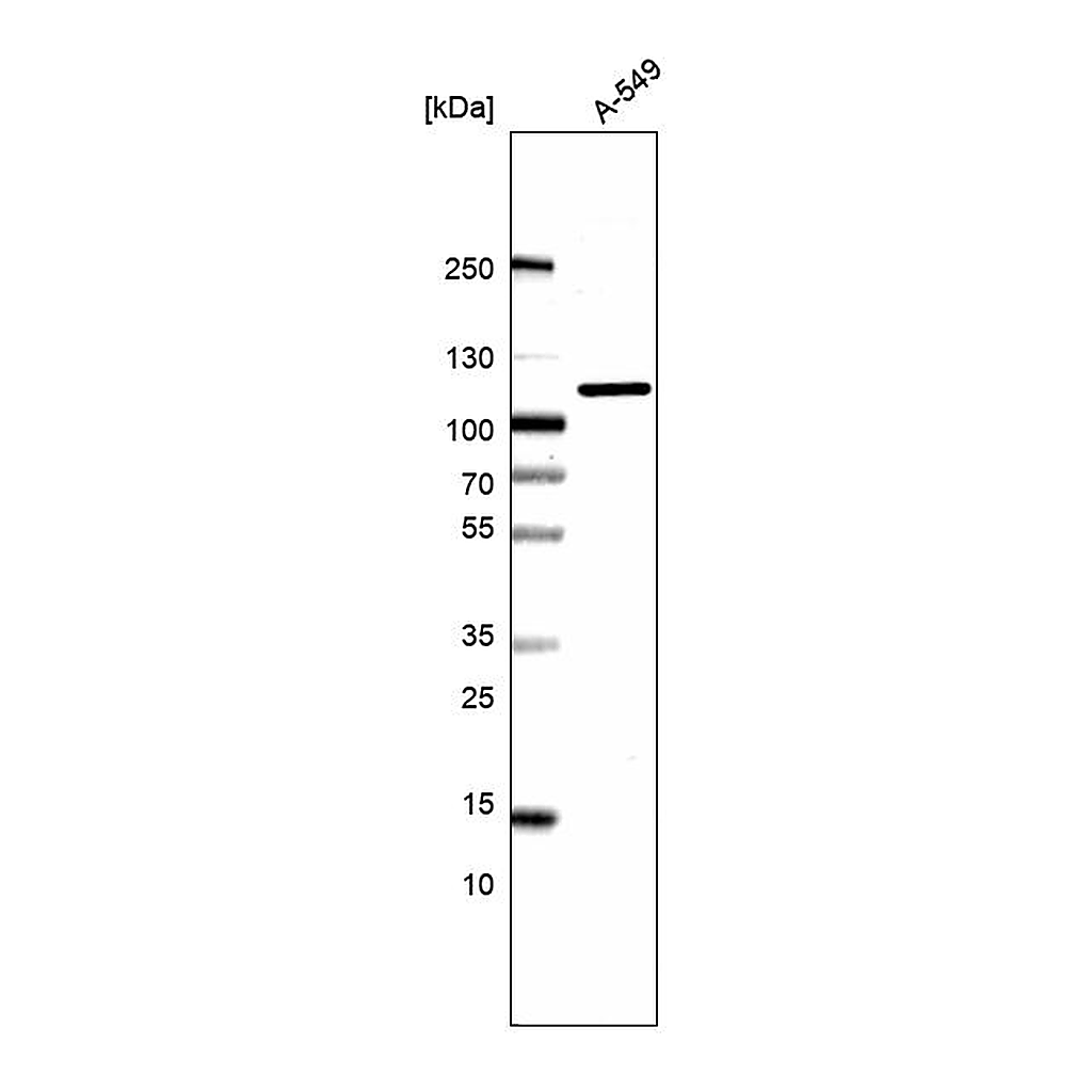 Atlas Antibodies Anti-AP2B1 Antibody