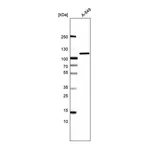 Atlas Antibodies Anti-AP2B1 Antibody