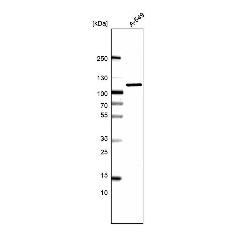 Atlas Antibodies Anti-AP2B1 Antibody