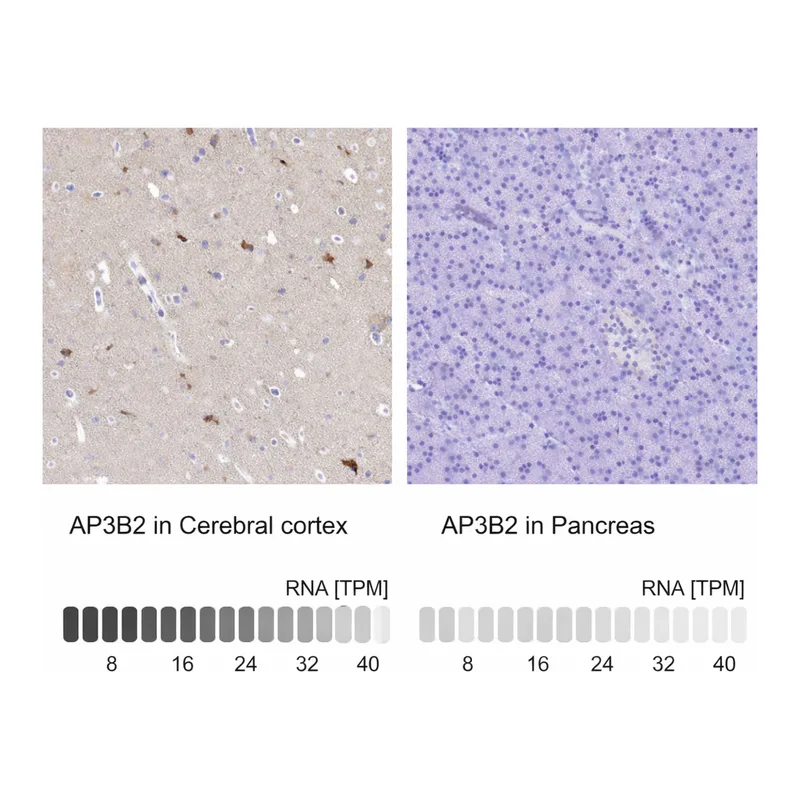 Atlas Antibodies Anti-AP3B2 Antibody
