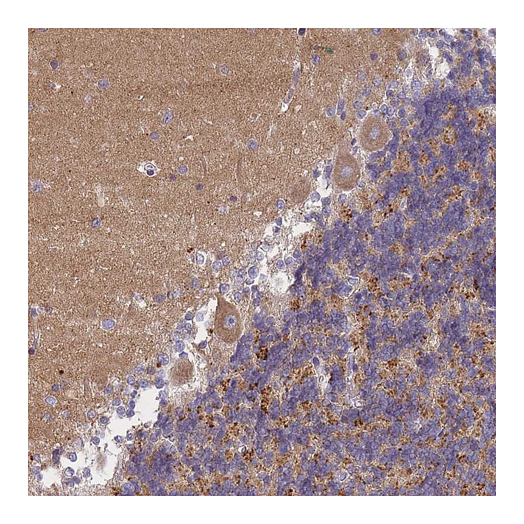 Atlas Antibodies Anti-AP3M1 Antibody