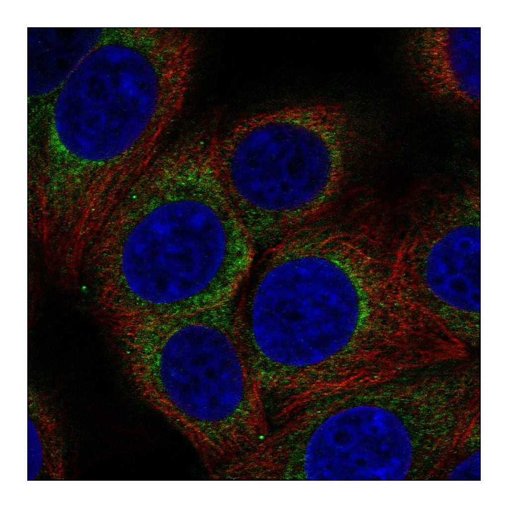 Atlas Antibodies Anti-AP3D1 Antibody