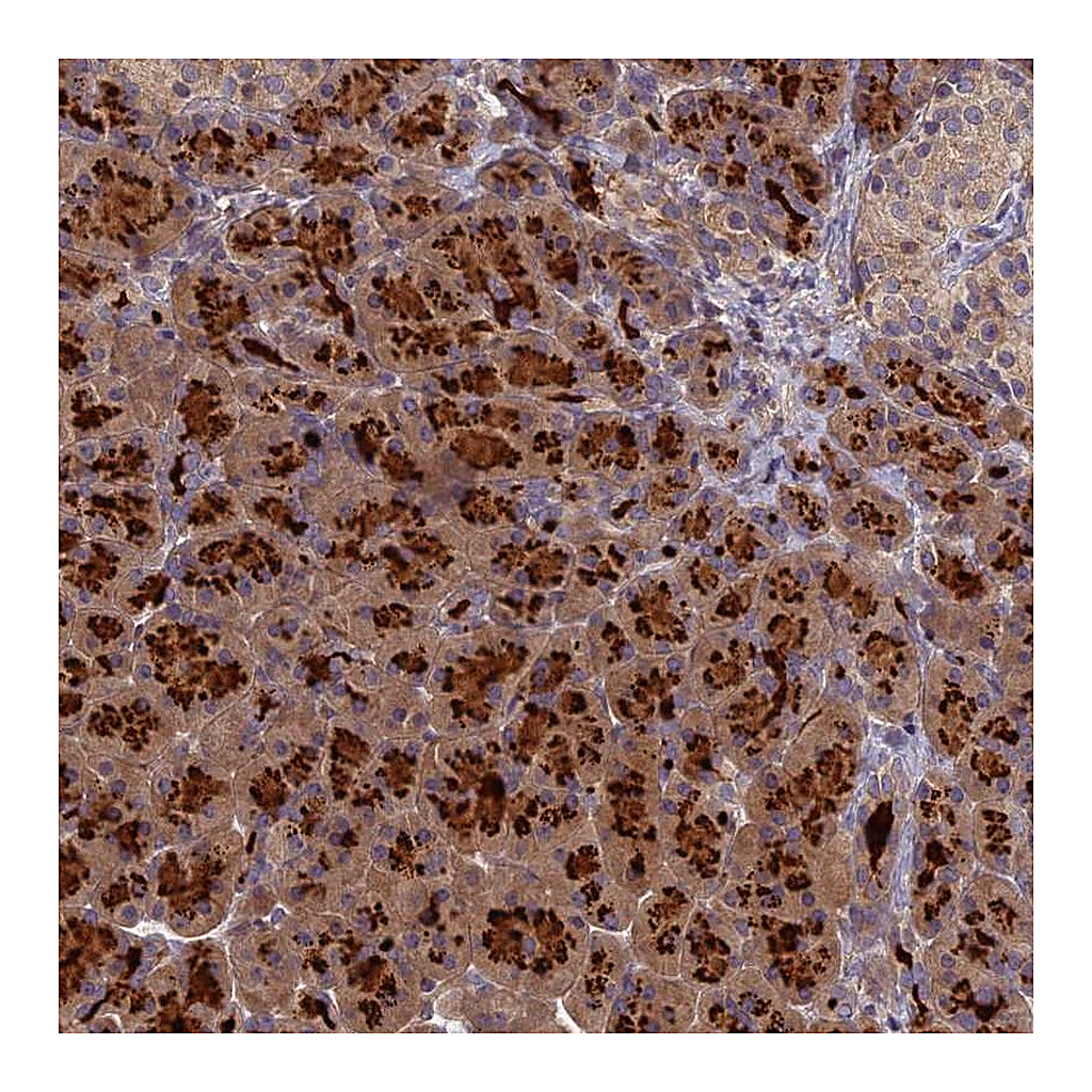 Atlas Antibodies Anti-AP4E1 Antibody