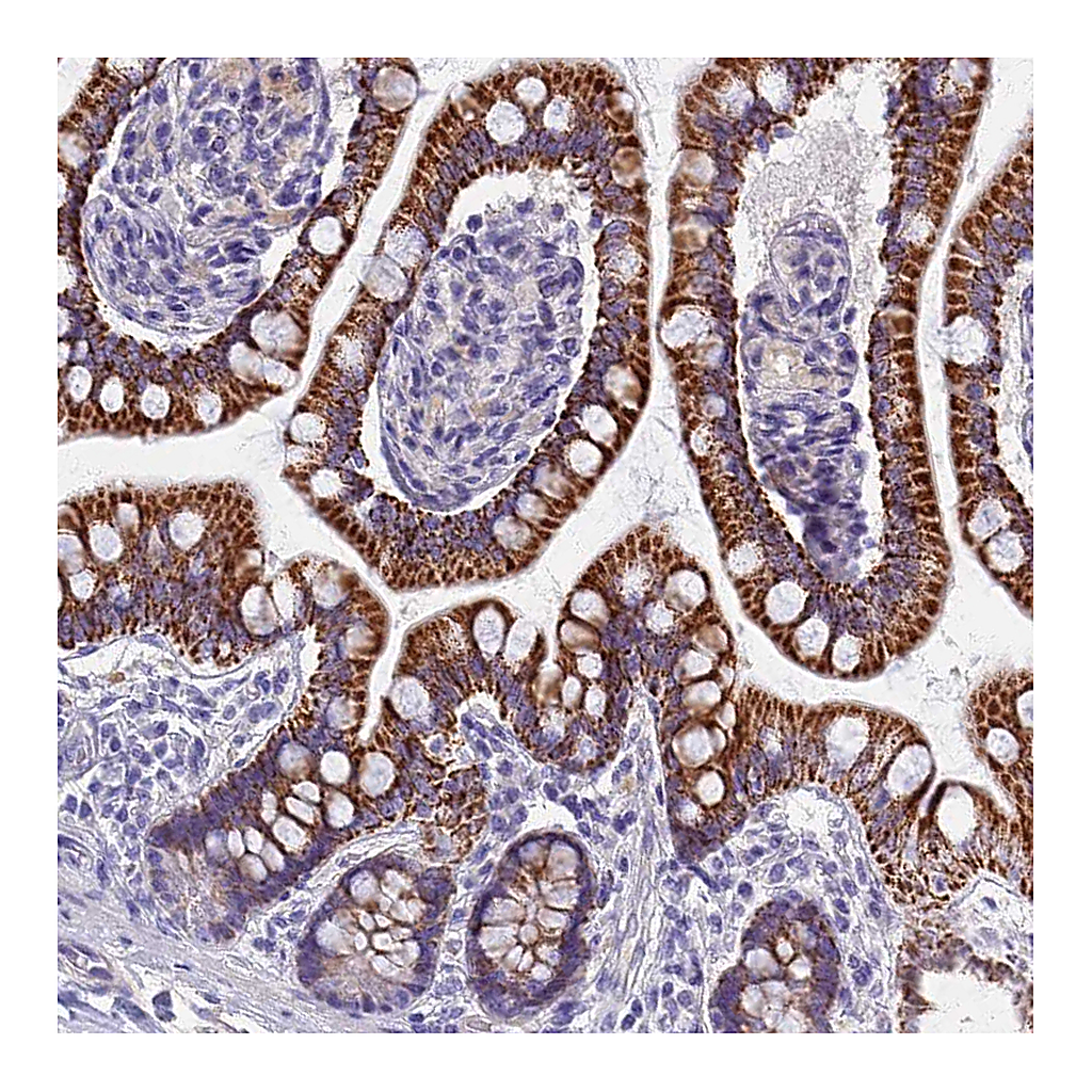 Atlas Antibodies Anti-AP4E1 Antibody