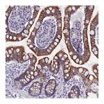 Atlas Antibodies Anti-AP4E1 Antibody