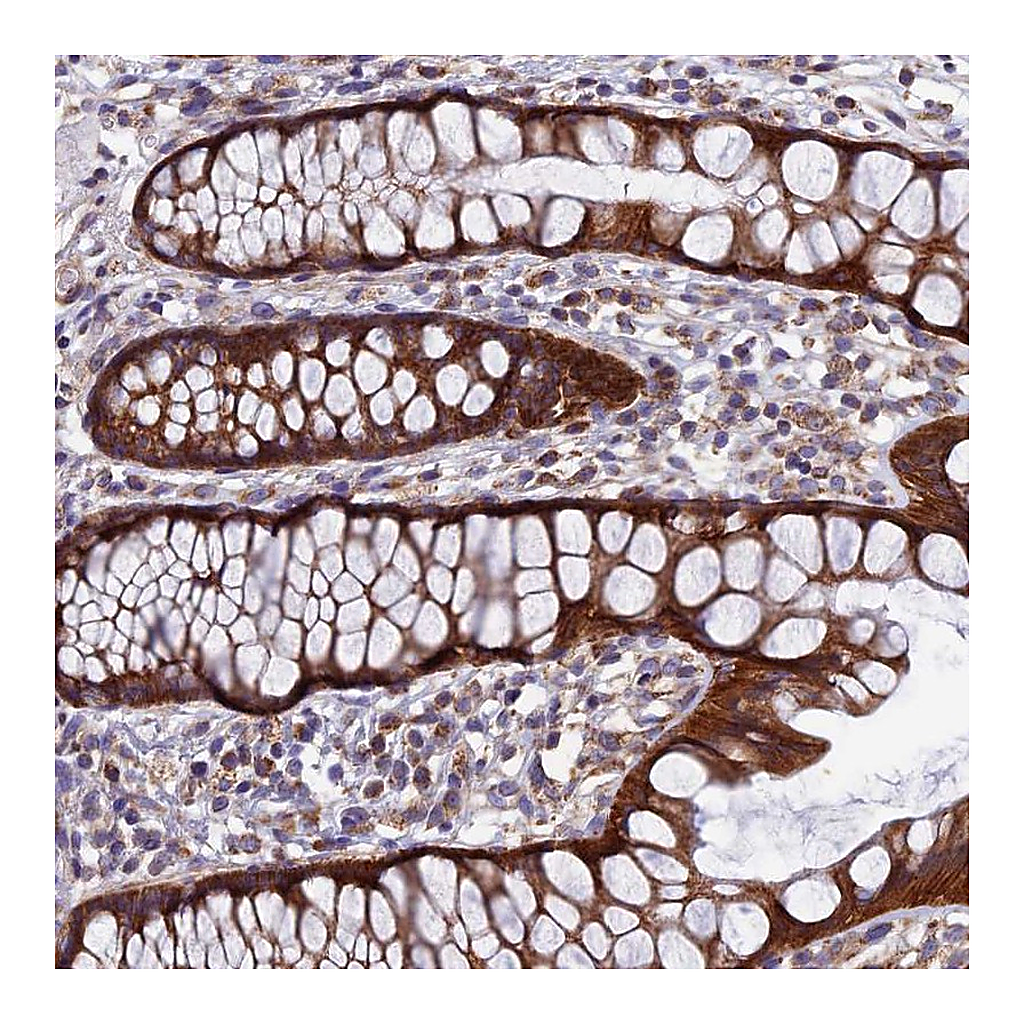 Atlas Antibodies Anti-AP4S1 Antibody