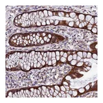 Atlas Antibodies Anti-AP4S1 Antibody