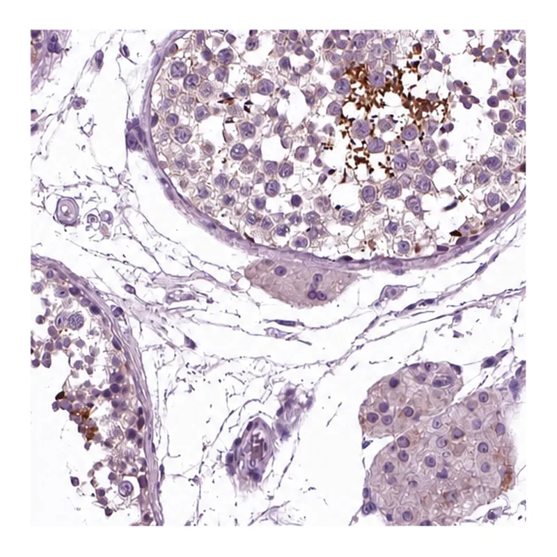 Atlas Antibodies Anti-AP4M1 Antibody