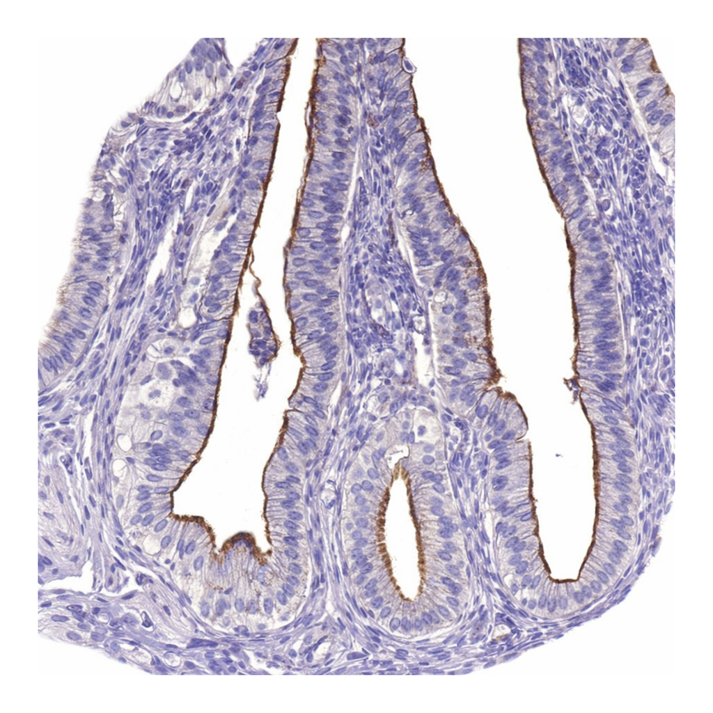 Atlas Antibodies Anti-AP5B1 Antibody
